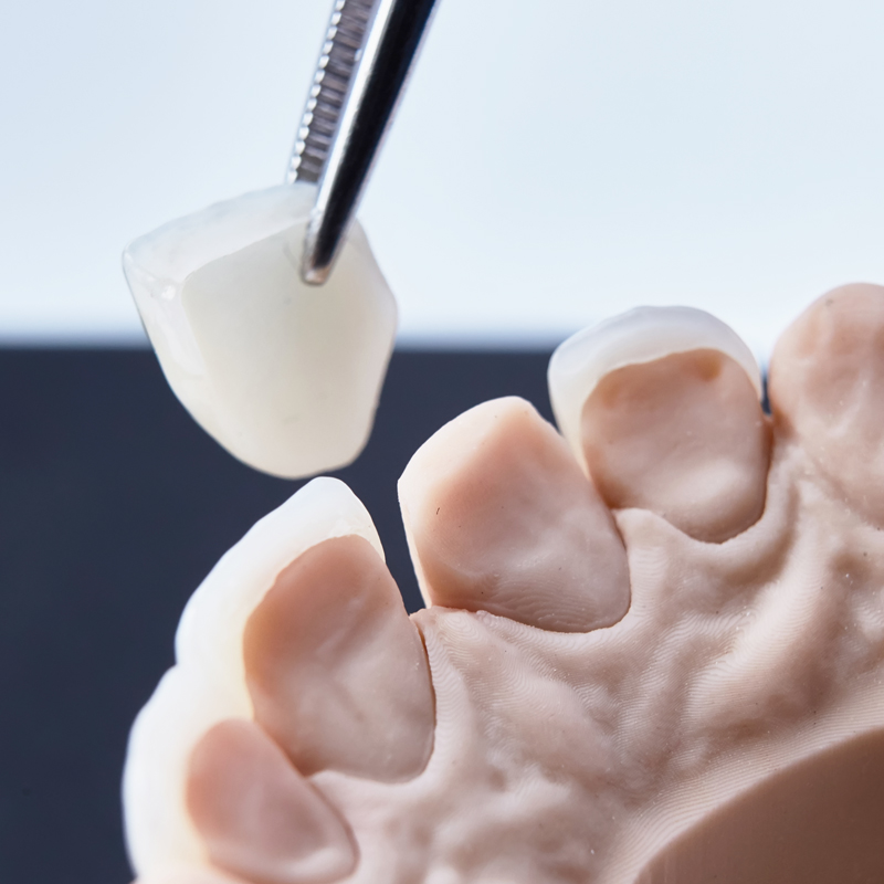 審美歯科の特徴2